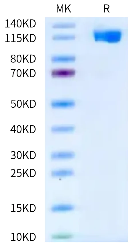 CD106-HF001 Bis-Tris-PAGE-white result