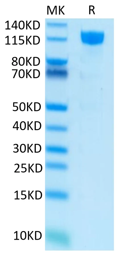 CD115-HF001 Bis-Tris-PAGE result