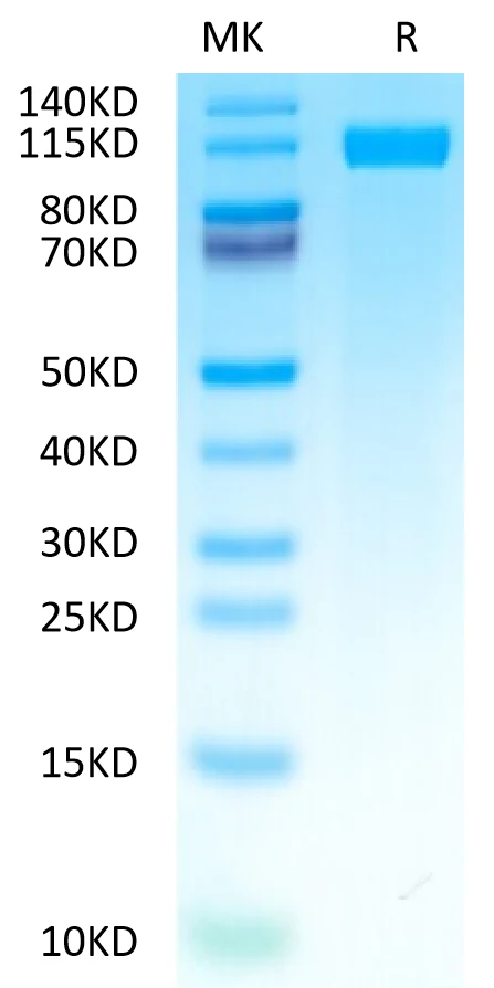 CD117-HF001 Bis-Tris-PAGE-white result