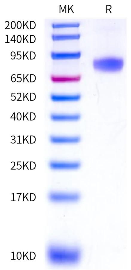 CD124-HF001 Bis-Tris-PAGE-white result