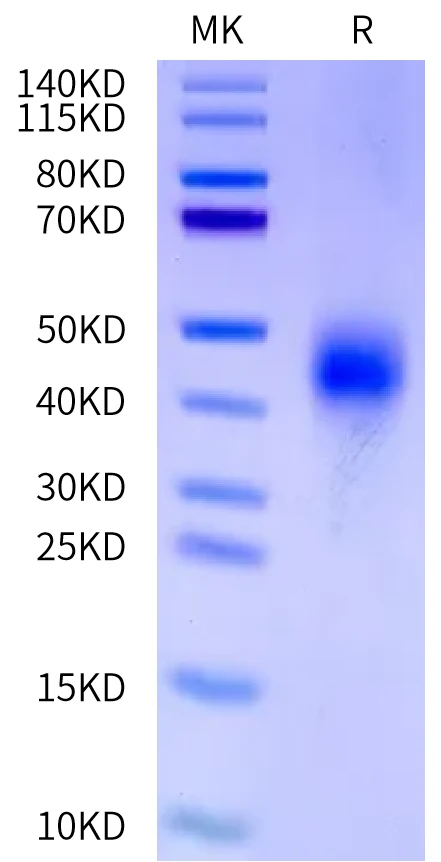 CD16-MB001 Bis-Tris-PAGE-white result