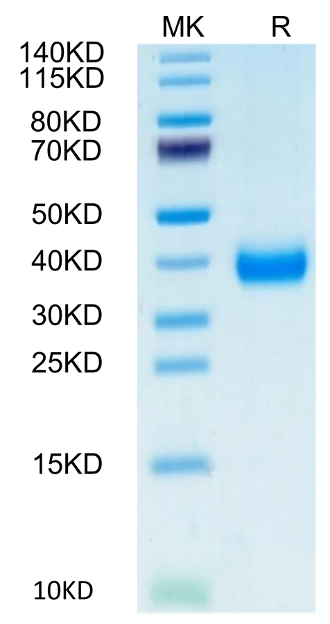 CD161-CB001 Bis-Tris-PAGE-white result