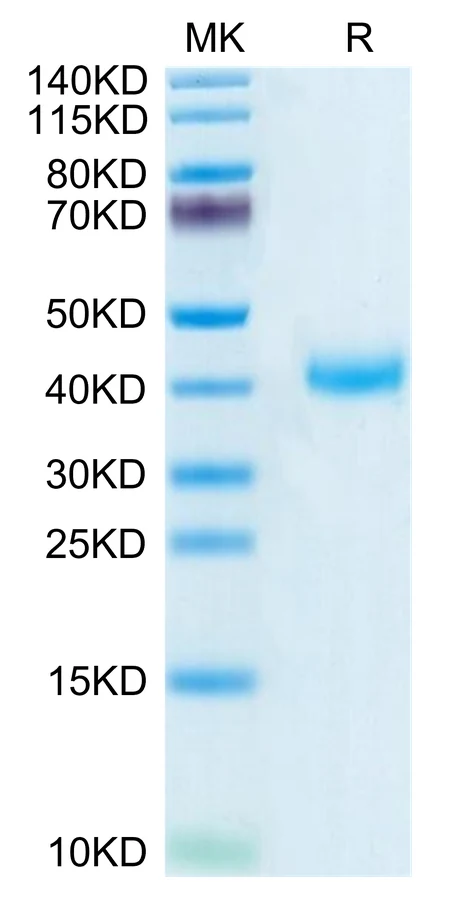 CD161-HB001 Bis-Tris-PAGE-white result