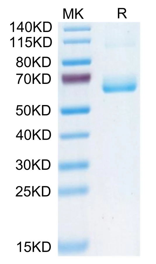 CD161-HF001 Bis-Tris-PAGE-white result
