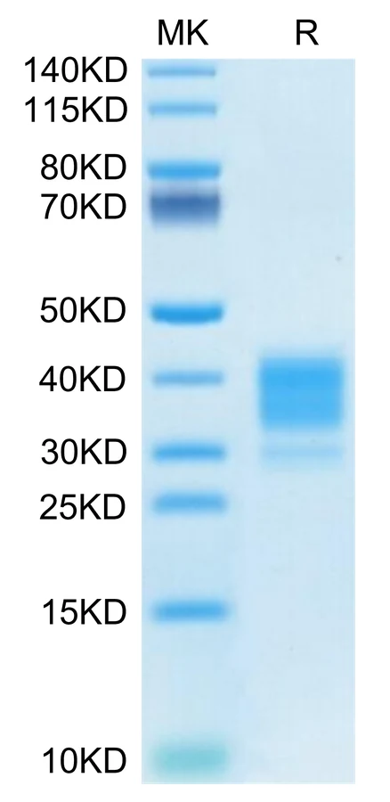 CD162-MP001 Bis-Tris-PAGE-white result