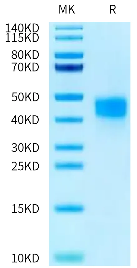 CD16B-HP001 Bis-Tris-PAGE-white result