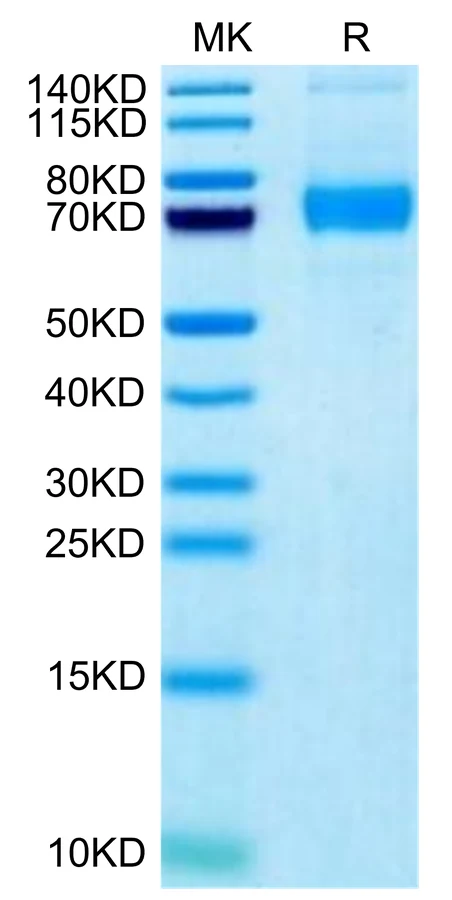 CD170-HB001 Bis-Tris-PAGE-white result