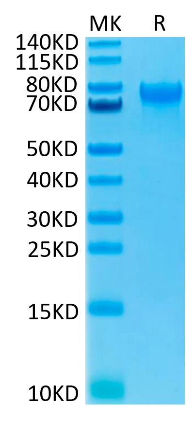 CD215-HF001 Bis-Tris-PAGE-white result