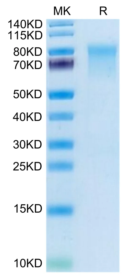 CD215-MF001 Bis-Tris-PAGE-white result
