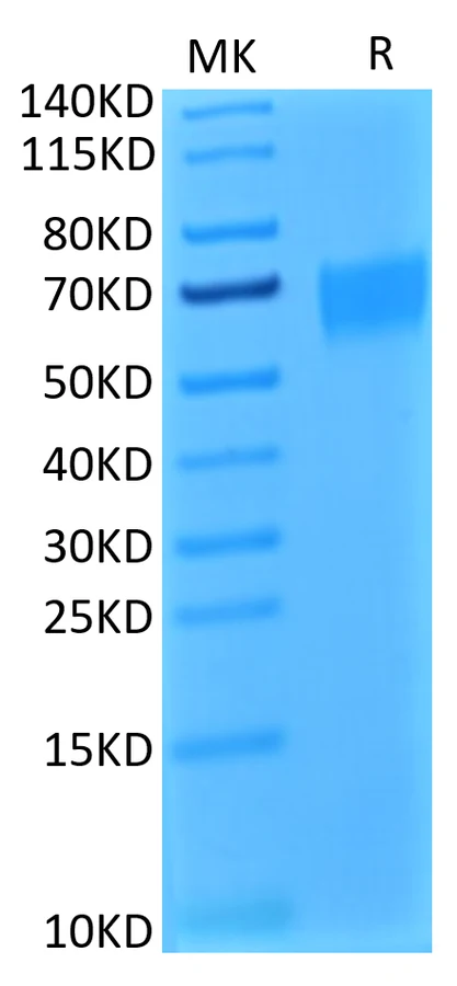 CD217-HB001 Bis-Tris-PAGE result
