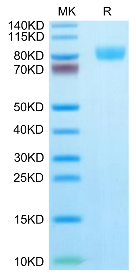 CD217-HF001 Bis-Tris-PAGE-white result