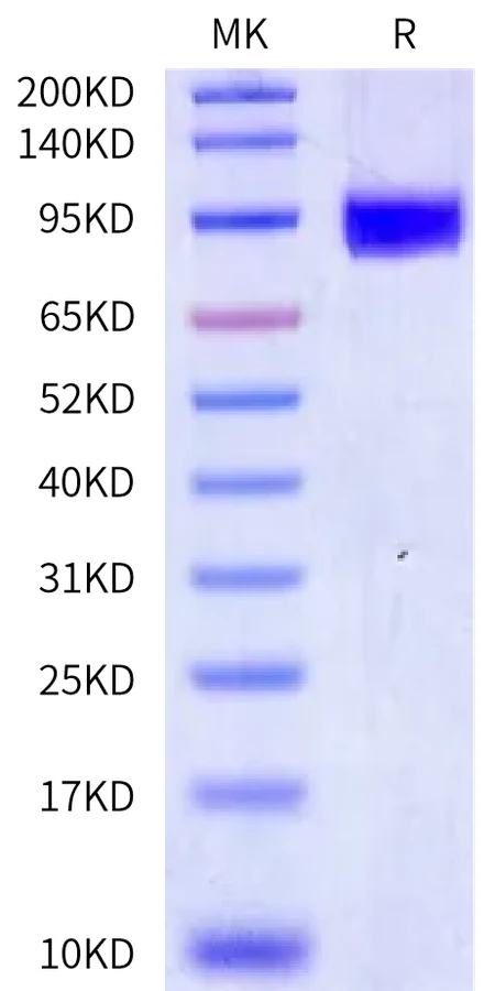 CD217-HF002 Bis-Tris-PAGE-white result