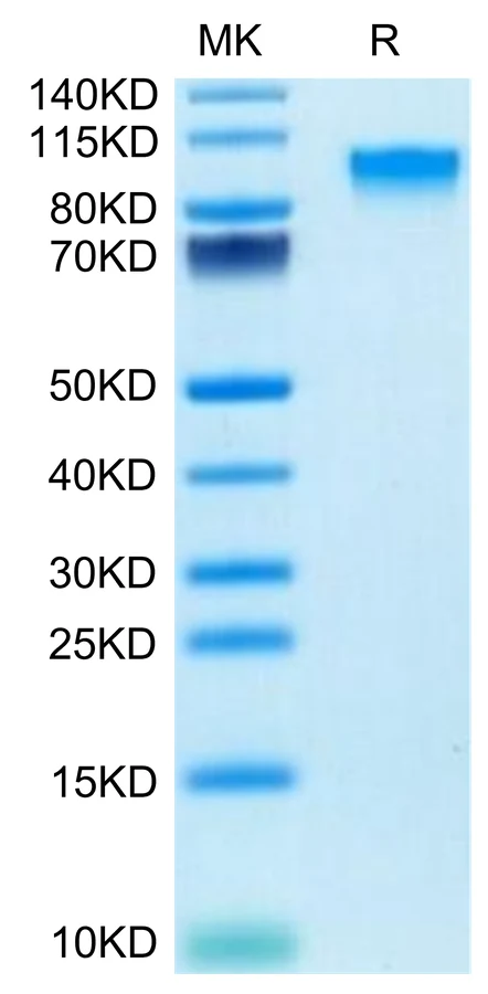 CD217-MF001 Bis-Tris-PAGE-white result