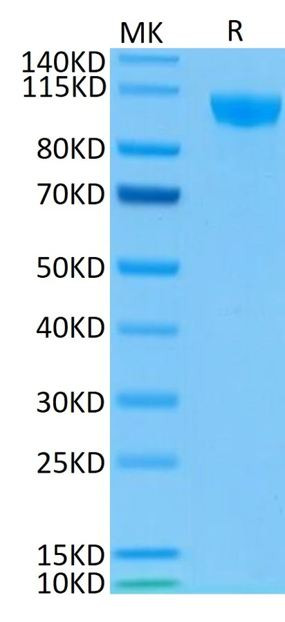 CD22-HB001 Bis-Tris-PAGE result