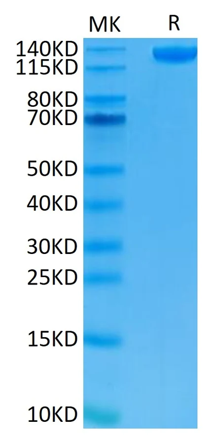 CD22-HF001 Bis-Tris-PAGE result