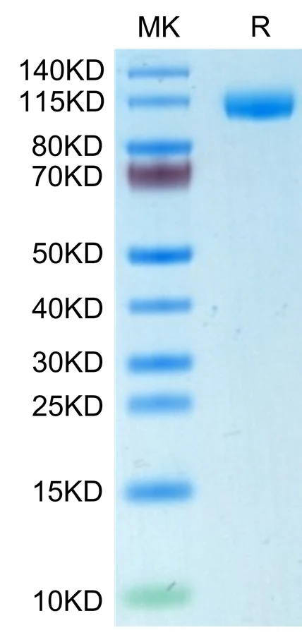CD22-HP001 Bis-Tris-PAGE-white result