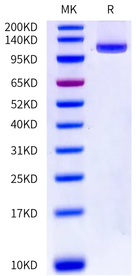 CD228-HF001 Bis-Tris-PAGE-white result