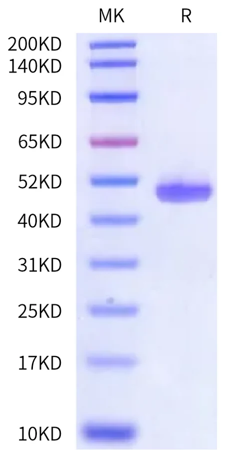 CD257-HF002 Bis-Tris-PAGE-white result