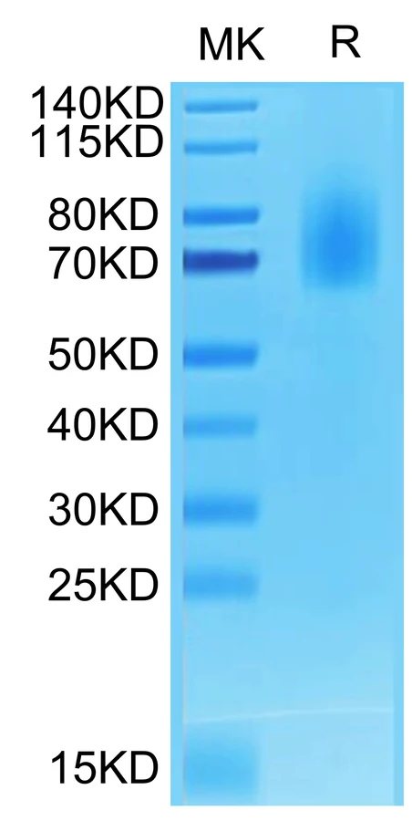 CD30-HB003 Bis-Tris-PAGE-white result