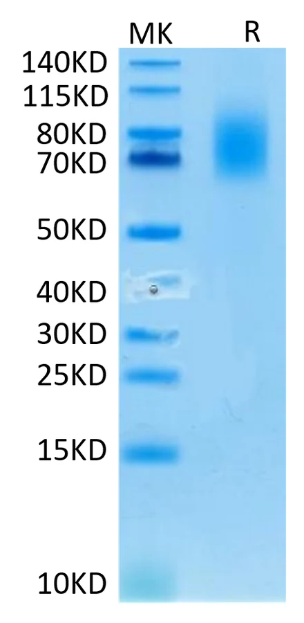 CD30-HP001 Bis-Tris-PAGE-white result