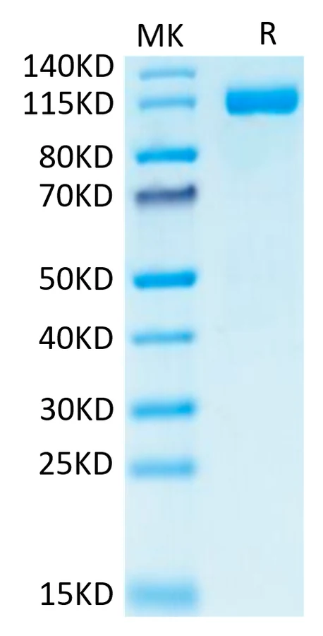 CD31-HF001 Bis-Tris-PAGE-white result
