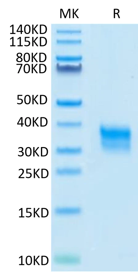 CD32A-CP001 Bis-Tris-PAGE-white result