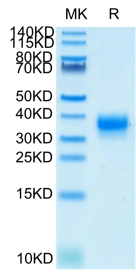 CD32A-HB001 Bis-Tris-PAGE-white result