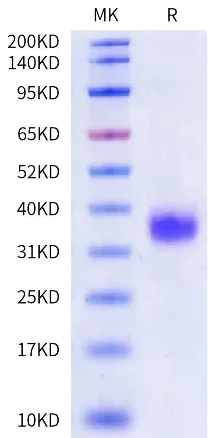 CD32A-HP002 Bis-Tris-PAGE-white result