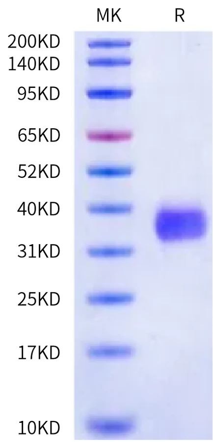 CD32A-HP003 Bis-Tris-PAGE-white result