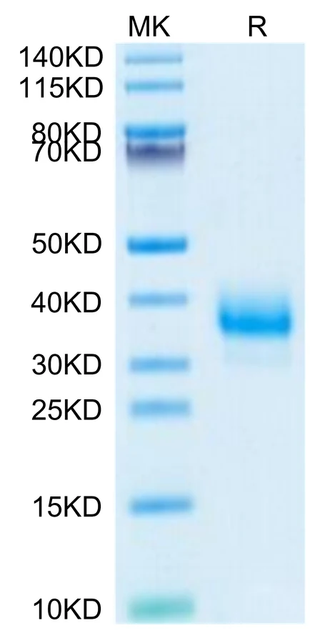 CD32B-CP001 Bis-Tris-PAGE-white result