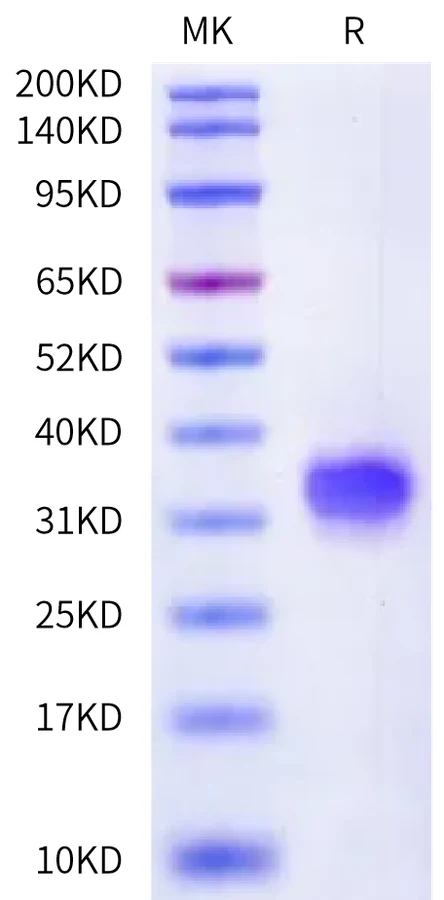 CD32BC-HP001 Bis-Tris-PAGE-white result