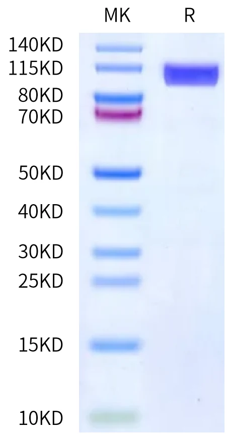 CD36-HF001 Bis-Tris-PAGE-white result