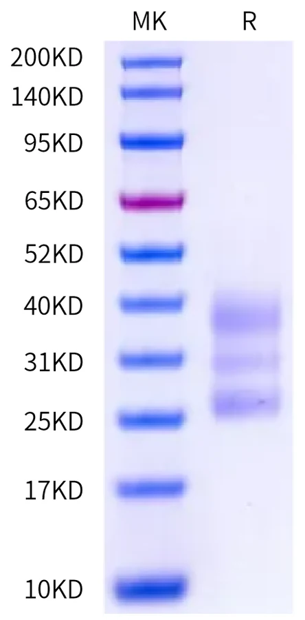 CD3E-HB004 Bis-Tris-PAGE-white result