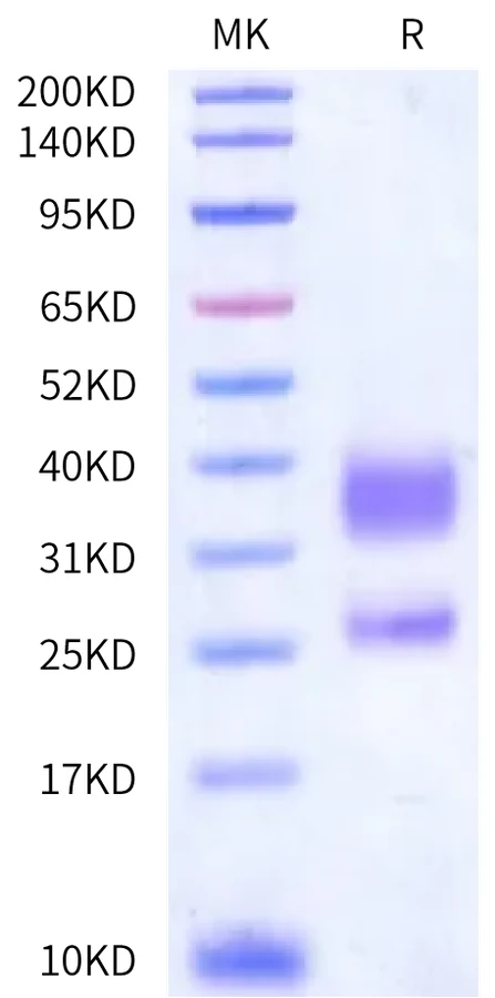 CD3ED-HP001 Bis-Tris-PAGE-white result