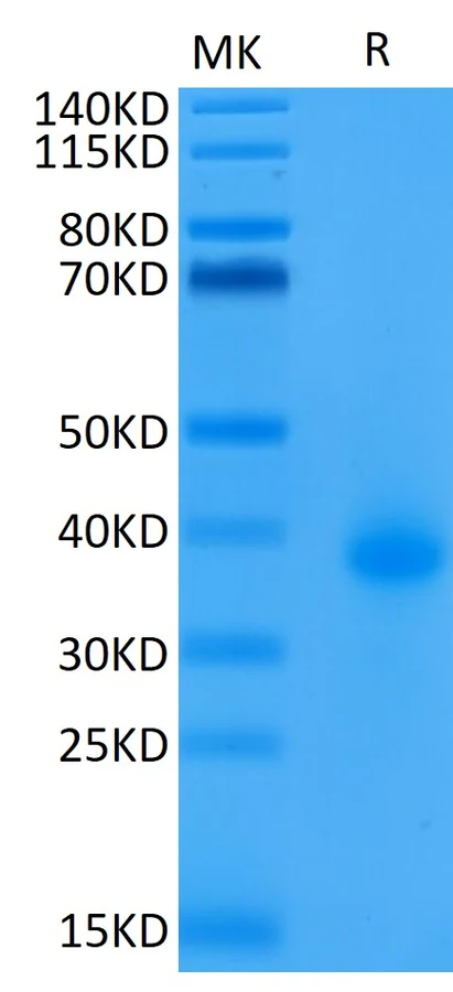 CD40-HB003 Bis-Tris-PAGE result