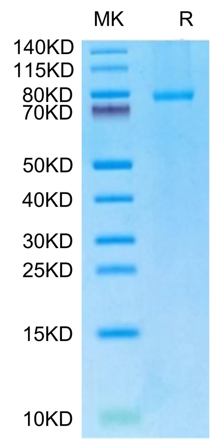 CD40-HF002 Bis-Tris-PAGE-white result