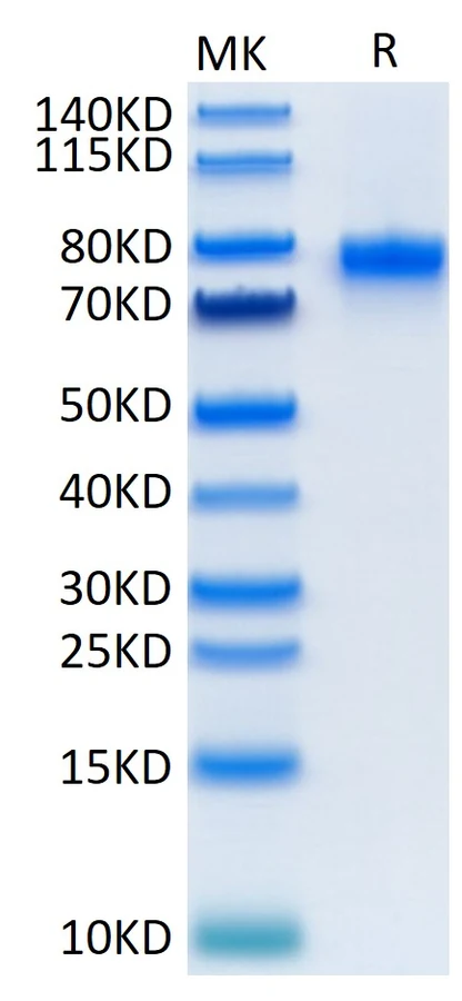 CD40-MF001 Bis-Tris-PAGE result