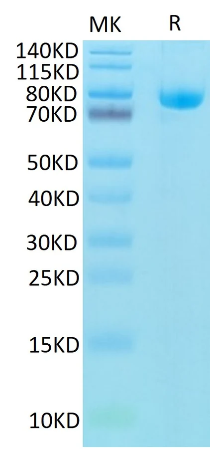 CD5-HF003 Bis-Tris-PAGE result