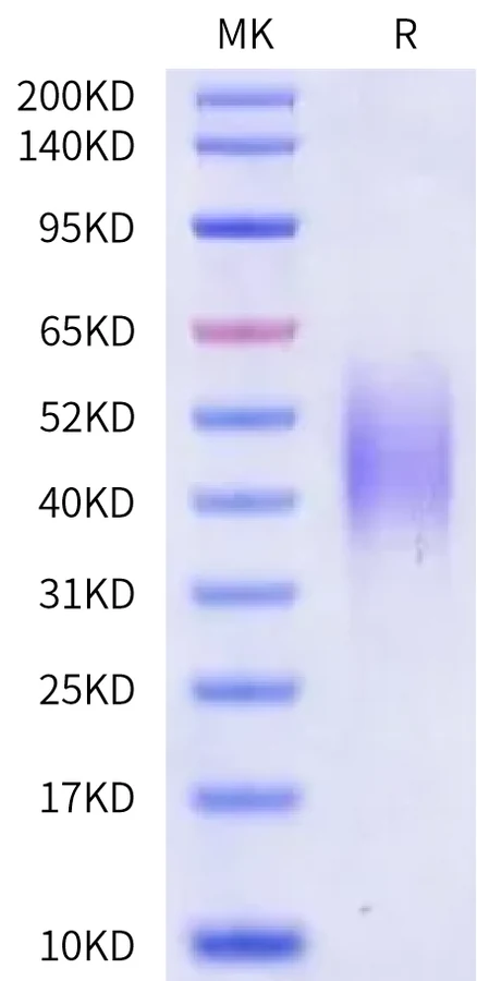 CD58-HB001 Bis-Tris-PAGE-white result