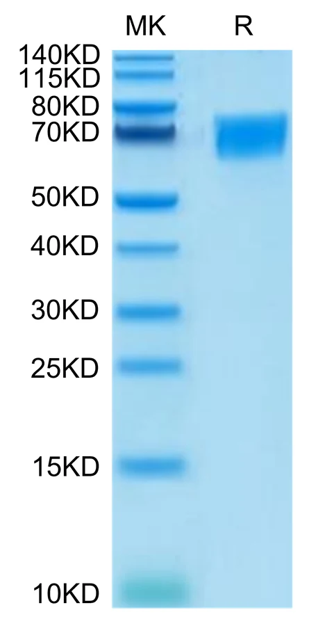 CD58-HF001 Bis-Tris-PAGE-white result