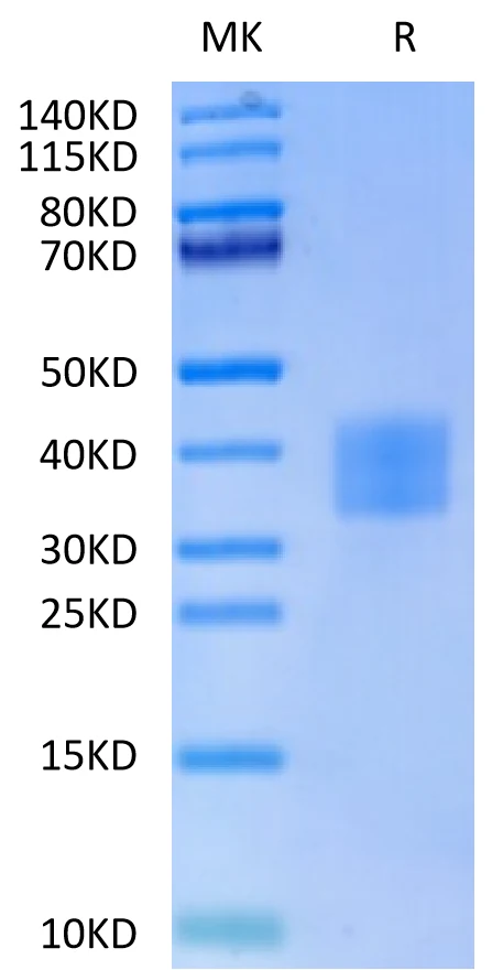CD7-HP001 Bis-Tris-PAGE-white result
