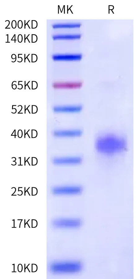 CD74-HB001 Bis-Tris-PAGE-white result