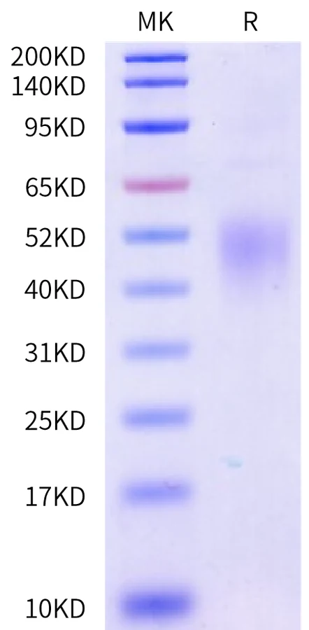 CD74-MB001 Bis-Tris-PAGE-white result