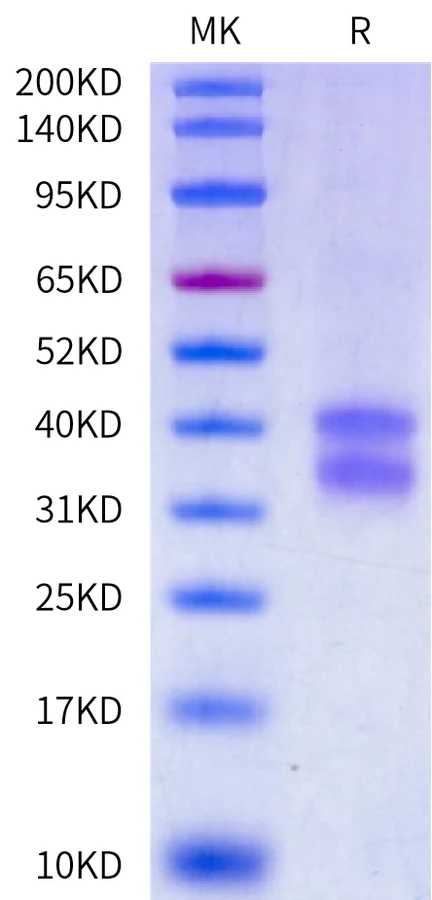 CD8-CB002 Bis-Tris-PAGE-white result