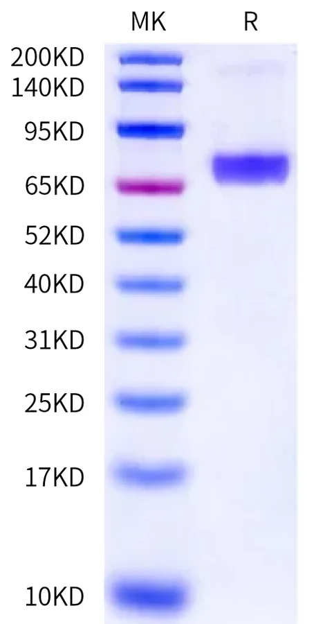 CD84-HF001 Bis-Tris-PAGE-white result