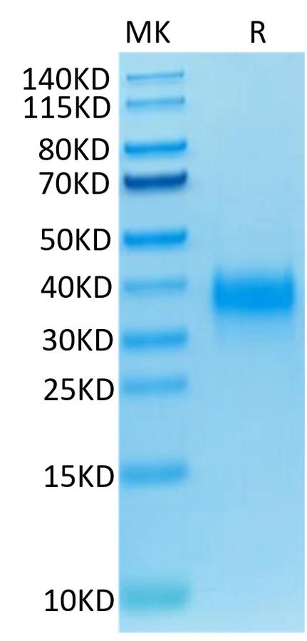 CD94-HB001 Bis-Tris-PAGE-white result