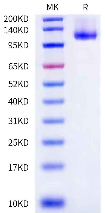 CDCP1-CB002 Bis-Tris-PAGE-white result