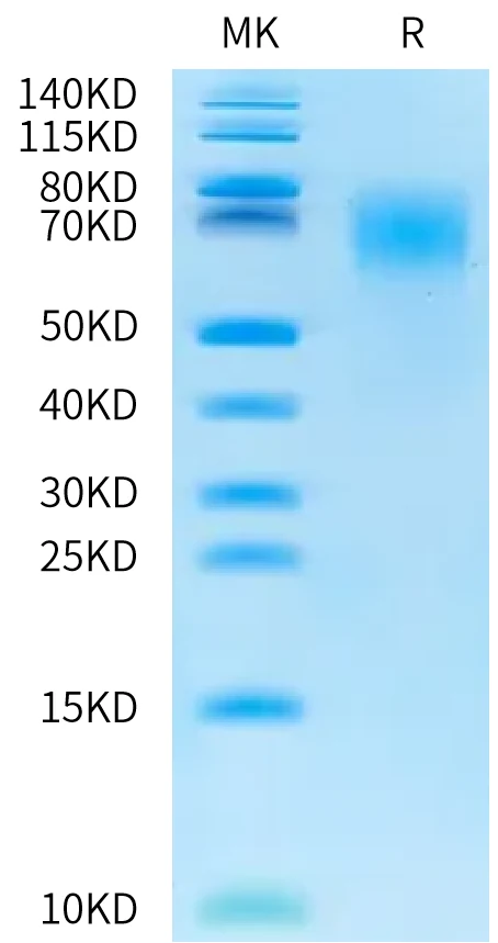 CEACAM6-CB001 Bis-Tris-PAGE-white result