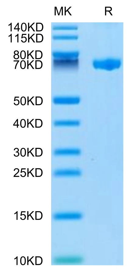 CLEC2D-HF001 Bis-Tris-PAGE-white result