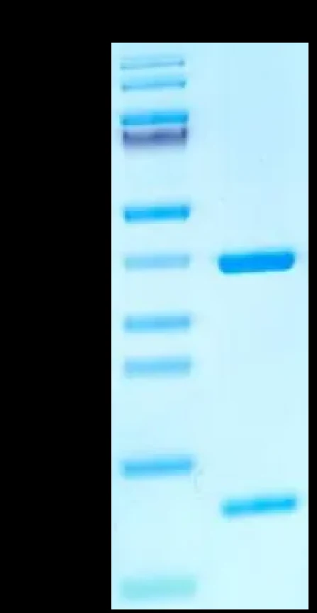 CMVPP65-HB002 Bis-Tris-PAGE result